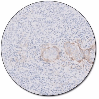 PD-L1 IHC 22C3 pharmDx for Autostainer Link 48